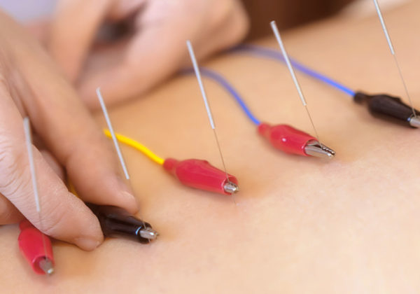 Ultrasound-guided percutaneous neuromodulation: An effective and precise method for chronic pain