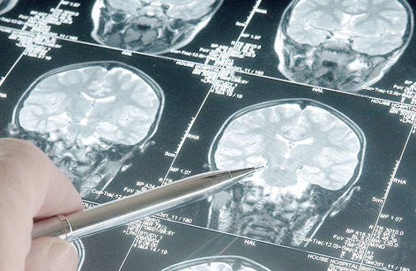 Trastorno por Déficit de Atención e Hiperactividad: causas y abordaje multidisciplinar